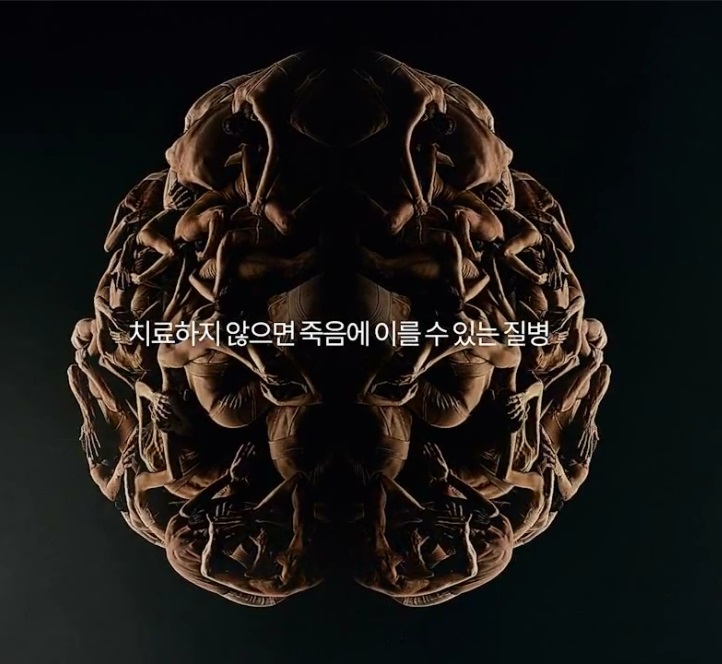 [금연캠페인-TV광고] 당신의 뇌를 고통스럽게 하는 질병게시물의 이미지